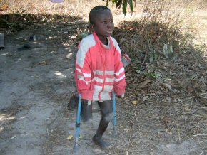 Modou Lamin before his operation